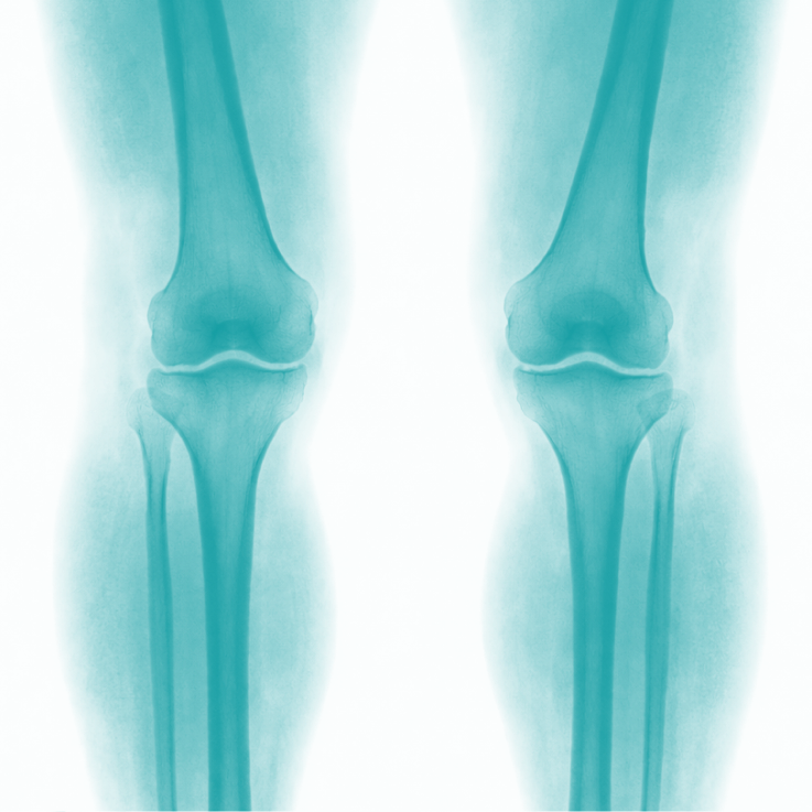 Orthopedic Marketing Agency